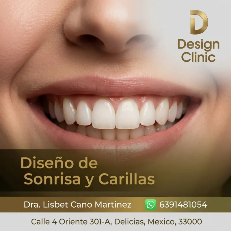 Consulta para Diseño de Sonrisa y Carillas